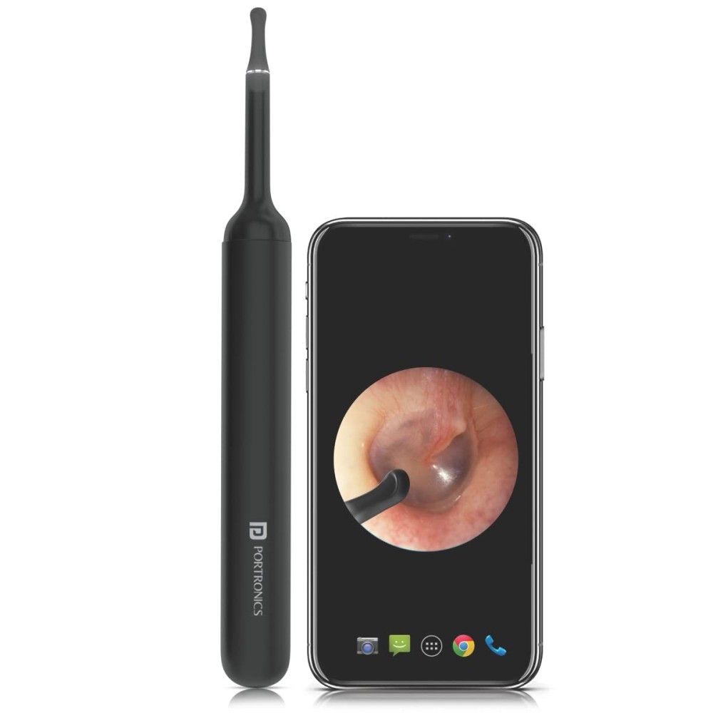 Portronics Xlife Smart Wireless Ear Otoscope Cleaner with 3MP FHD 1080P Camera, 6 LED Lights, App-Controlled Ear Cleaning Endoscope, Visual Ear Wax Removal Tool – (Black)
