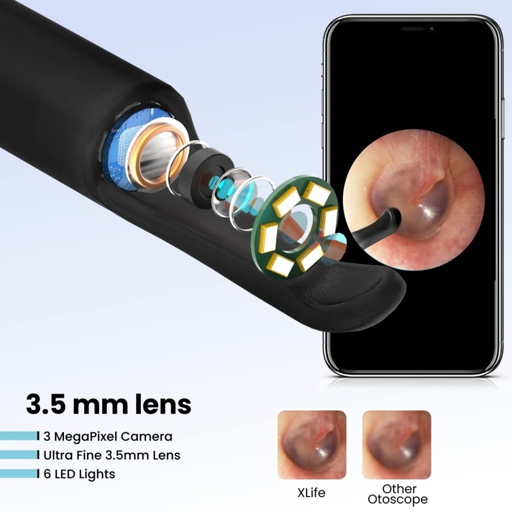 Portronics Xlife Smart Wireless Ear Otoscope Cleaner with 3MP FHD 1080P Camera, 6 LED Lights, App-Controlled Ear Cleaning Endoscope, Visual Ear Wax Removal Tool – (Black)