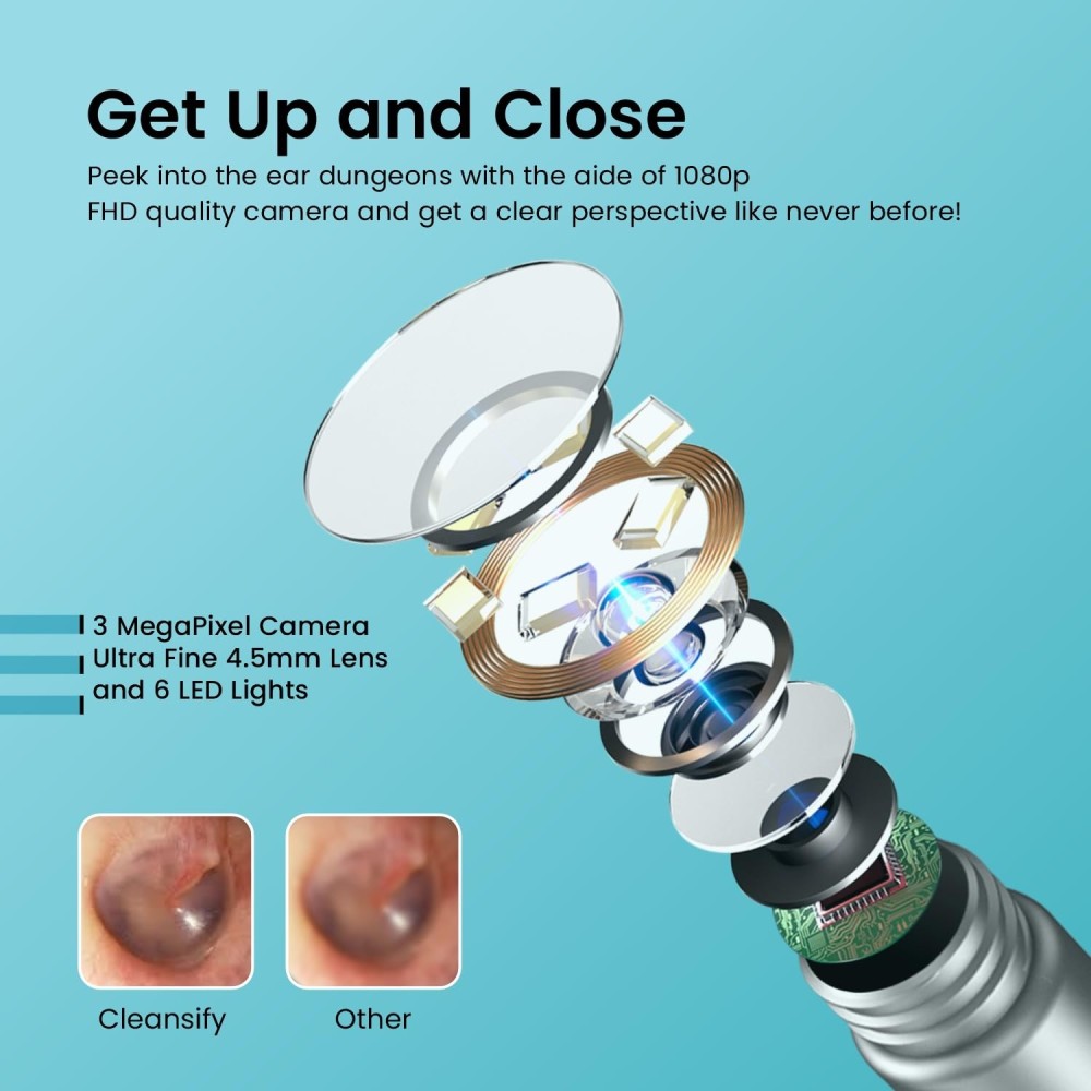Portronics Cleansify Ear Endoscope Otoscope & Ear Wax Cleaner with 1080p Full HD Camera, Ultra-Fine 4.5mm Lens, Ear Inspection Tool for Kids & Adults – (Black)